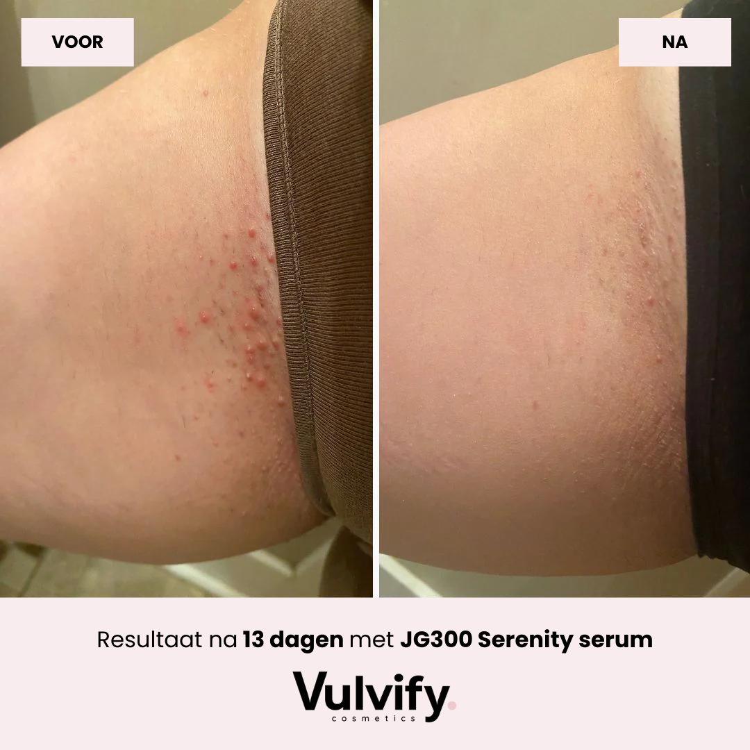 Serenity™ | JG300 Yoni Serum